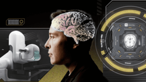 Giấc mơ cấy chip vào não người điên rồ của Elon Musk: Tự chế tạo robot phẫu thuật, sẽ thực hiện hơn 22.000 cuộc giải phẫu vào năm 2030, chi phí mỗi ca 10.000 USD