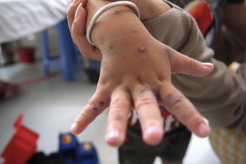 <a href="/xa-hoi" title="Xã hội" rel="dofollow">Xã hội</a>