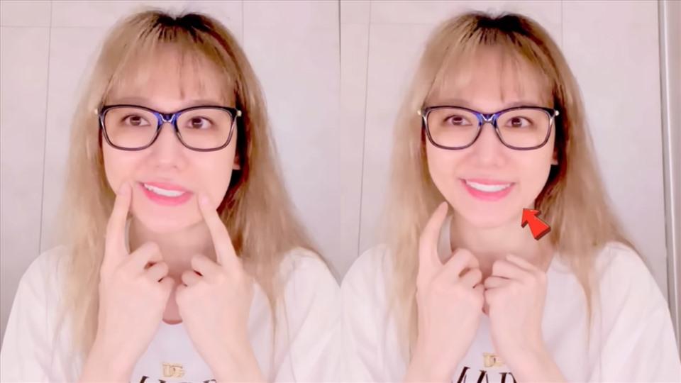 Hari Won cho biết, nửa bên mặt bên trái của cô vẫn đơ và chưa thể trở lại trạng thái bình thường. Ảnh: CMH.