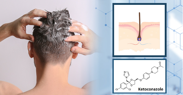 Thương hiệu dầu gội sạch gàu được tin dùng 10 năm qua - Ảnh 3.