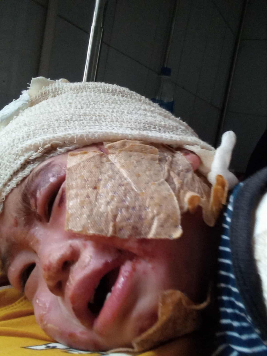 Những tiếng khóc yếu ớt vì đau đớn của bé Như Quỳnh khiến người chứng kiến nhói lòng. anh3.jpg