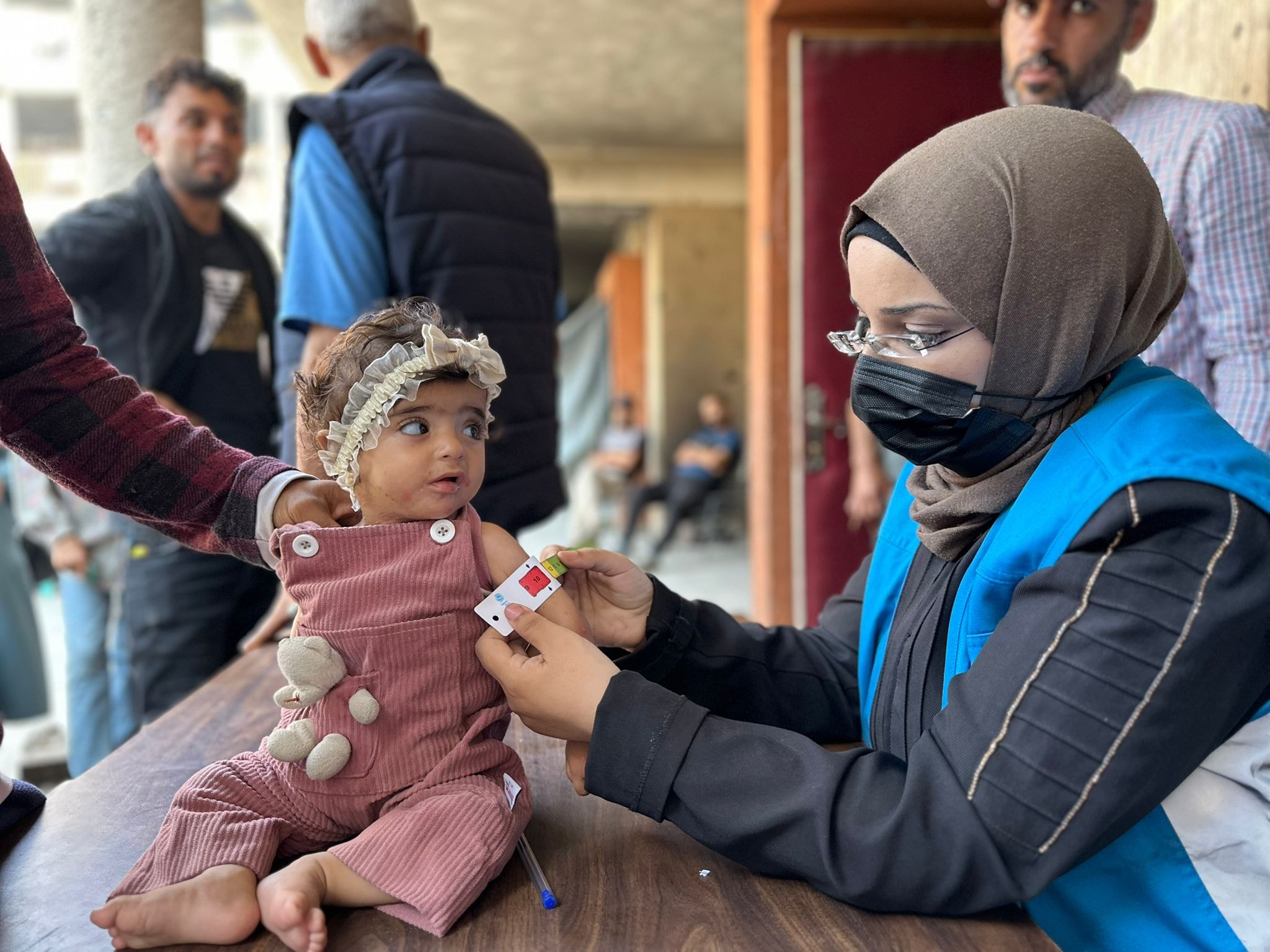 Em bé được nhân viên y tế của UNRWA sàng lọc suy dinh dưỡng tháng 7 năm 2025. Ảnh: UNRWA