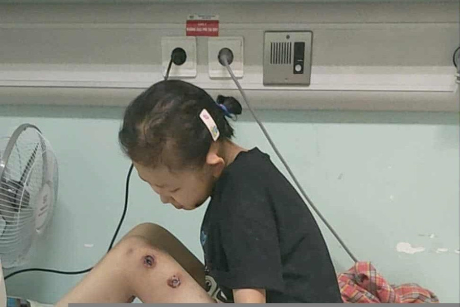 Căn bệnh đã khiến thân hình Hà Linh lở loét, tiều tụy. 20270-4252-80.jpg